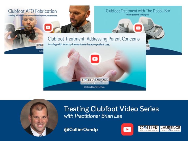 clubfoot video series with Brian Lee, click to watch
